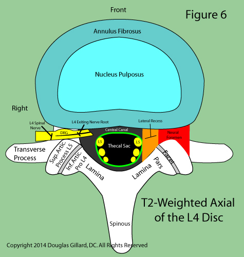 axial cartoon